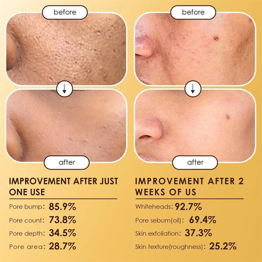 Dr Melaxin Peel Shot