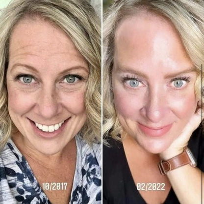 SAAM - Young & Radiance Serum (Original)