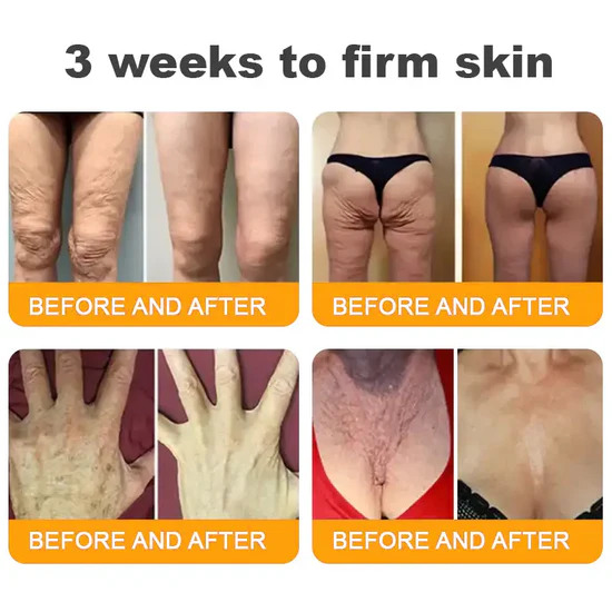 South Moon Bee Venom Pain Relief Cream for Arthritis, Muscle & Joint Discomfort (Original)