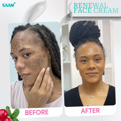 SAAM Renewal Face Cream Original | Daily Moisturizing & Skin Repair Cream