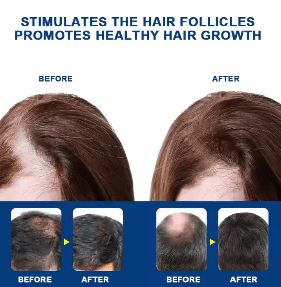 Sumifun - Hair Growth Cream (Original)