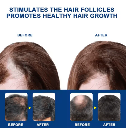 Sumifun - Hair Growth Cream (Original)