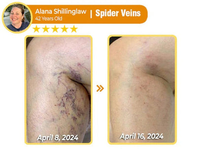 South Moon Bee Venom Pain Relief Cream for Arthritis, Muscle & Joint Discomfort (Original)